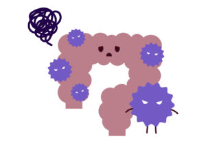 大腸がんの新たなリスク要因「細菌毒素」が注目される理由