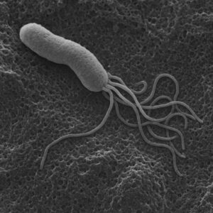 【胃がんで助かるために】症状がない進行胃がんを防ぐには？内視鏡医が語る「胃を切除しないための選択