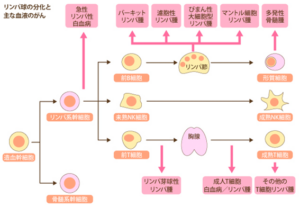 胃悪性リンパ腫について胃にもリンパ腫？？